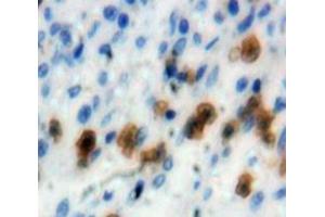 Used in DAB staining on fromalin fixed paraffin-embedded Spleen tissue (IRF4 anticorps  (AA 175-433))