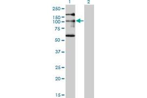 Western Blot analysis of NBR1 expression in transfected 293T cell line by NBR1 monoclonal antibody (M05), clone 5C3. (NBR1 anticorps  (AA 2-96))