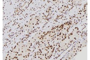 ABIN6276688 at 1/100 staining Human kidney tissue by IHC-P. (p21 anticorps  (Internal Region))