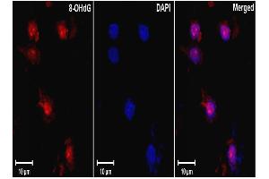 DNARNA Damage (15A3), ischemic rat brain tissue. (DNA Damage anticorps)