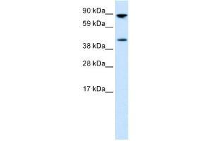 WB Suggested Anti-ETV4 Antibody Titration: 0. (ETV4 anticorps  (Middle Region))