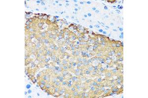 Immunohistochemistry of paraffin-embedded mouse pancreatic islet using TSC1 antibody (ABIN6133755, ABIN6149609, ABIN6149610 and ABIN6213968) at dilution of 1:200 (40x lens).