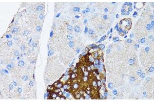 Immunohistochemistry of paraffin-embedded Mouse pancreatic islet using TIMP2 Polyclonal Antibody at dilution of 1:150 (40x lens). (TIMP2 anticorps)