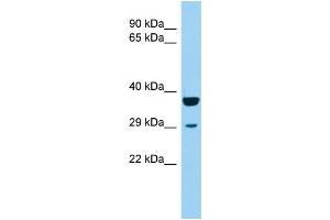 Host: Rabbit Target Name: KCTD1 Sample Type: 721_B Whole Cell lysates Antibody Dilution: 1. (KCTD1 anticorps  (Middle Region))