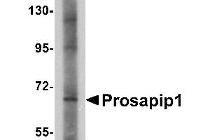 Western blot analysis of Prosapip1 in SK-N-SH cell lysate with Prosapip1 antibody at 1 µg/mL. (ProSAPiP1 anticorps  (C-Term))