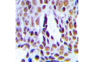 anti-Integrator Complex Subunit 6 (INTS6) antibody