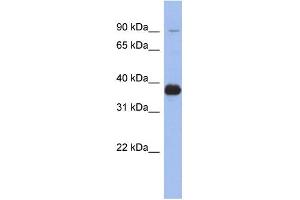 WB Suggested Anti-MPP3 Antibody Titration: 0. (MPP3 anticorps  (Middle Region))