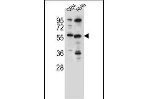 CSAD Antibody (Center) (ABIN655728 and ABIN2845175) western blot analysis in CEM,A549 cell line lysates (35 μg/lane). (CSAD anticorps  (AA 197-226))