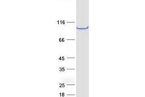 Validation with Western Blot