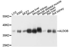 Western blot analysis of extracts of various cell lines, using ALDOB antibody. (ALDOB anticorps  (AA 1-200))
