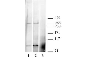 CABIN1 antibody (pAb) tested by Immunoprecipitation / Western blot. (CABIN1 anticorps  (C-Term))