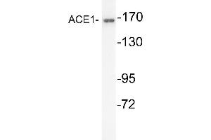 Western blot (WB) analysis of ACE1 antibody in extracts from mouse kidney cells.
