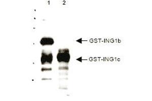 Western blot analysis using anti-p33 ING1 antibody to detect over expressed Human ING1 present in cell nuclear extracts. (ING1 anticorps  (AA 285-296))