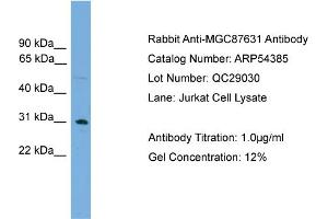 WB Suggested Anti-MGC87631  Antibody Titration: 0. (MGC87631 (Middle Region) anticorps)
