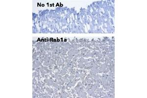 Immunohistochemistry (IHC) image for anti-RAB1A, Member RAS Oncogene Family (RAB1A) (C-Term) antibody (ABIN7272978)
