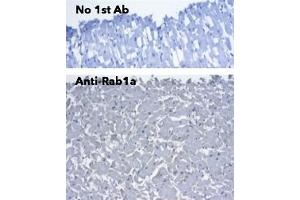 Immunohistochemistry (IHC) image for anti-RAB1A, Member RAS Oncogene Family (RAB1A) (C-Term) antibody (ABIN7272978) (RAB1A anticorps  (C-Term))