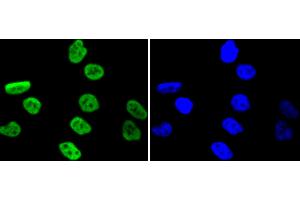 PC-3 cells were stained with MSK1 (Ser376) (11A1) Monoclonal Antibody  at [1:200] incubated overnight at 4C, followed by secondary antibody incubation, DAPI staining of the nuclei and detection. (MSK1 anticorps  (pSer376))