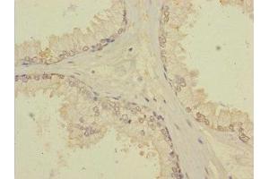 anti-Tetratricopeptide Repeat Domain 12 (TTC12) (AA 1-260) antibody