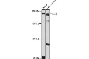 Western blot analysis of extracts of various cell lines, using  antibody (ABIN6131182, ABIN6136830, ABIN6136831 and ABIN6222940) at 1:1000 dilution. (ALS2 anticorps  (AA 1-280))