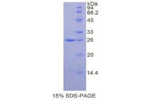 SDS-PAGE (SDS) image for TIMP Metallopeptidase Inhibitor 3 (TIMP3) (AA 27-209) protein (His tag) (ABIN2122232)