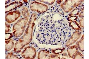 Immunohistochemistry of paraffin-embedded human kidney tissue using ABIN7162222 at dilution of 1:100 (ONECUT2 anticorps  (AA 214-331))