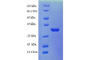 Kallikrein B, Plasma (Fletcher Factor) 1 (KLKB1) (AA 391-638), (Light Chain) protein (His tag)