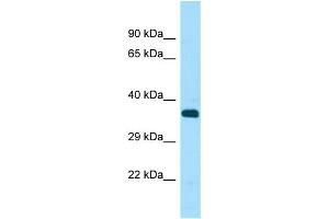 Western Blotting (WB) image for anti-serine/threonine Kinase 33 (STK33) (C-Term) antibody (ABIN2506070) (STK33 anticorps  (C-Term))