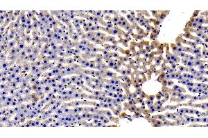 Detection of gp130 in Rat Liver Tissue using Polyclonal Antibody to Glycoprotein 130 (gp130)