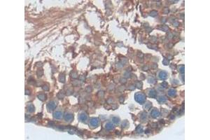 IHC-P analysis of Kidney tissue, with DAB staining. (S100A16 anticorps  (AA 1-97))