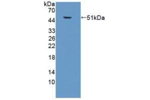 Detection of Recombinant SPC, Mouse using Polyclonal Antibody to Surfactant Protein C (SP-C)