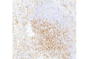Immunohistochemistry (IHC) image for anti-CD4 (CD4) (AA 407-457) antibody (ABIN7453902)