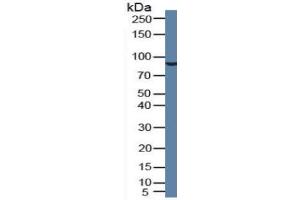 Rabbit Detection antibody from the kit in WB with Positive Control: Human blood cells. (PLG Kit CLIA)