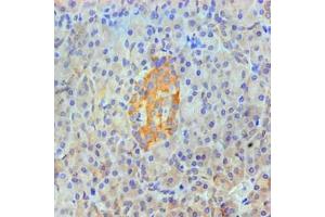 Immunohistochemical of paraffin-embedded Human pancreas tissue using ABIN7144345 at dilution of 1:200. (Annexin A2 anticorps)