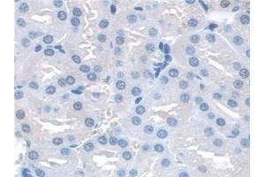 Detection of SNAP23 in Mouse Kidney Tissue using Polyclonal Antibody to Synaptosomal Associated Protein 23 kDa (SNAP23)