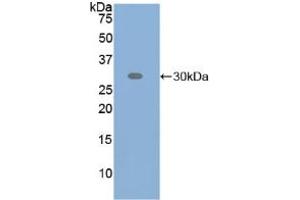 Western blot analysis of recombinant Human ATF6. (ATF6 anticorps  (AA 423-646))