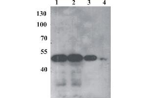 Western Blot testing of anti-BPV E2 monoclonal antibody (1E4). (Bovine Papilloma Virus 1 E2 (BPV-1 E2) (AA 250-280) anticorps)
