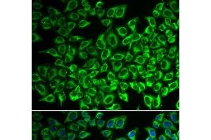 Immunofluorescence analysis of A549 cells using IL12RB1 Polyclonal Antibody (IL12RB1 anticorps)