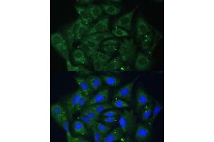 anti-Insulin-Like Growth Factor 2 mRNA Binding Protein 2 (IGF2BP2) (AA 330-599) antibody