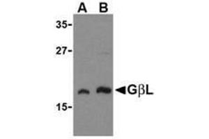 Western blot analysis of GbL in human brain cell lysate with AP30359PU-N GbL antibody at (A) 1 and (B) 2 μg/ml. (GBL anticorps)