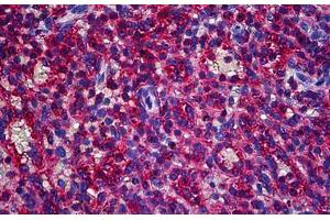 Human Spleen: Formalin-Fixed, Paraffin-Embedded (FFPE) (CAPZB anticorps  (AA 192-272))
