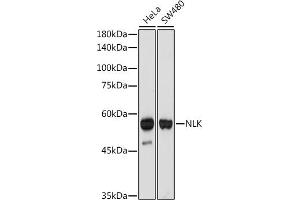 Western blot analysis of extracts of various cell lines, using NLK antibody (ABIN7268846) at 1:1000 dilution.