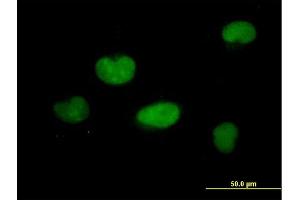 Immunofluorescence of purified MaxPab antibody to ZNF449 on HeLa cell. (ZNF449 anticorps  (AA 1-518))
