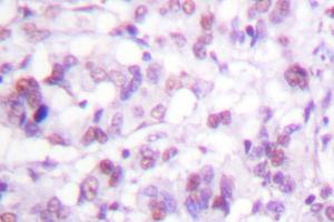 Image no. 1 for anti-V-Myb Myeloblastosis Viral Oncogene Homolog (Avian) (MYB) antibody (ABIN272041) (MYB anticorps)