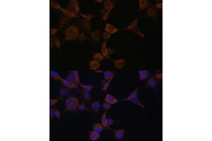 Immunofluorescence analysis of NIH-3T3 cells using AMPKβ1 Polyclonal Antibody (ABIN6129906, ABIN6146174, ABIN6146176 and ABIN7101403) at dilution of 1:100 (40x lens). (PRKAB1 anticorps  (AA 1-80))