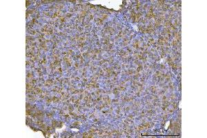 IHC analysis of RBP1 using anti-RBP1 antibody (ABIN7599586). (RBP1 anticorps  (AA 10-135))
