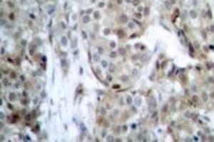 Image no. 2 for anti-BCL2-Associated Agonist of Cell Death (BAD) (pSer112), (pSer75) antibody (ABIN318169) (BAD anticorps  (pSer75, pSer112))