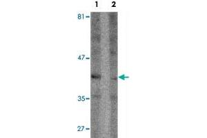 Western blot analysis of Raji cell lysate with SEPT1 polyclonal antibody  at 1 ug/mL in (1) the absence and (2) the presence of blocking peptide. (Septin 1 anticorps  (C-Term))