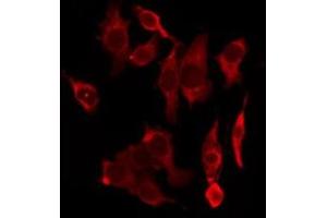 ABIN6277418 staining HeLa by IF/ICC. (P2RY4 anticorps  (C-Term))