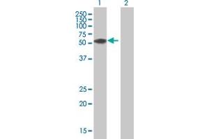 Western Blot analysis of ZNF276 expression in transfected 293T cell line by ZNF276 MaxPab polyclonal antibody. (ZNF276 anticorps  (AA 1-373))