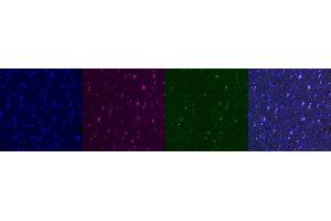 Immunohistochemistry (IHC) image for anti-Interferon gamma (IFNG) antibody (ABIN7456092)